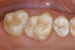 stomatologia zachowawcza